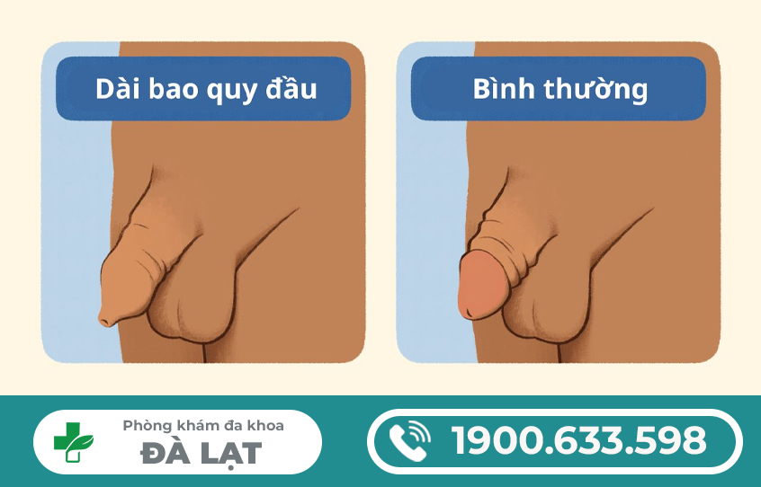 Hình ảnh minh họa